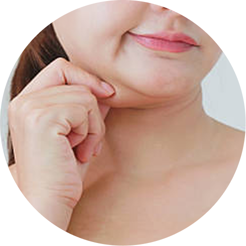 이중턱 추천 시술 3