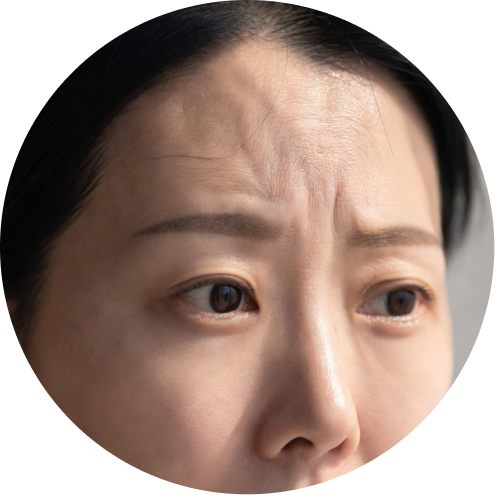 눈매교정 추천 시술 2