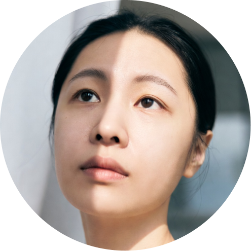 눈매교정 추천 시술 3