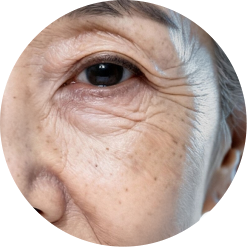 눈매교정 추천 시술 5