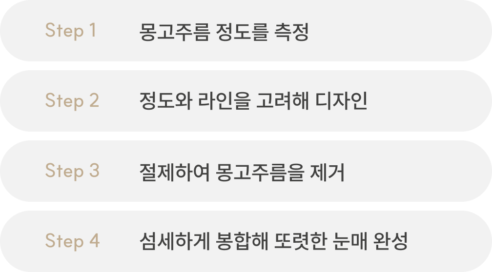 앞트임 수술 이미지