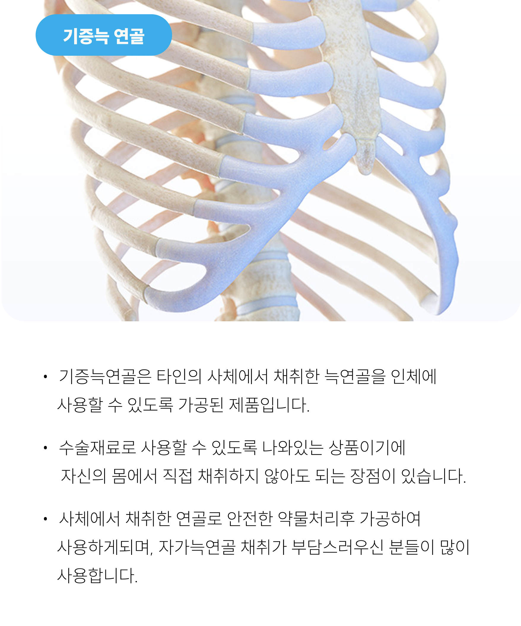 자가늑연골 / 기증늑연골 이미지