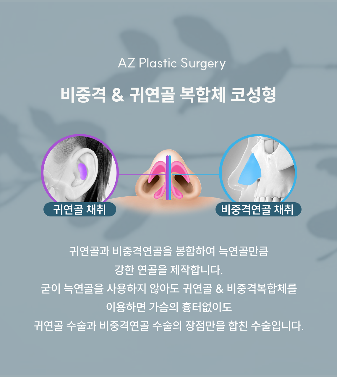 비중격 & 귀연골 복합체 코성형 이미지