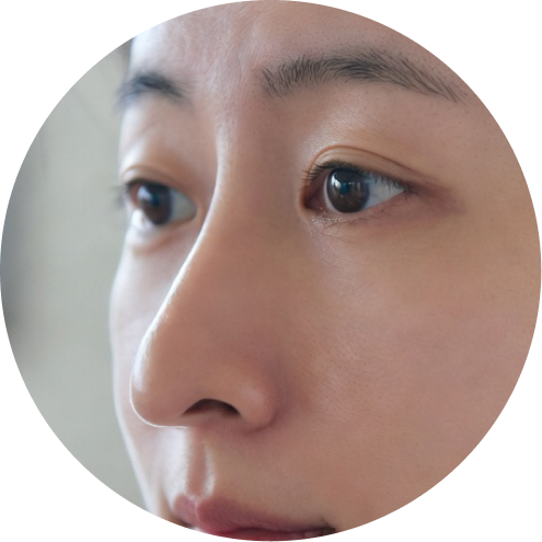 재수술 추천 시술 1